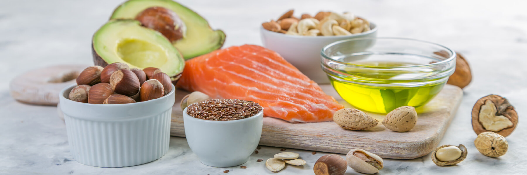 Kaip pasirūpinti tinkamu cholesterolio kiekiu?